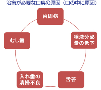 治療が必要な口臭の原因（口の中に原因）